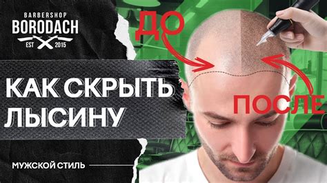 Профилактика лысины на голове