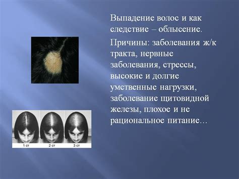 Профилактика повреждений волос и их рост