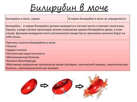 Профилактика повышенного уровня билирубина