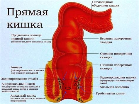 Профилактика полипа в прямой кишке