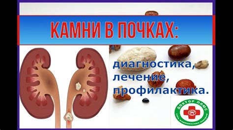 Профилактика породинок на почках