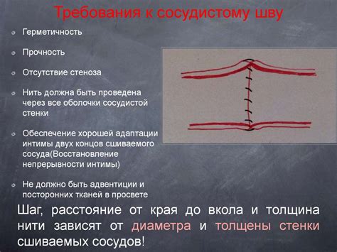 Профилактика расслоения шва
