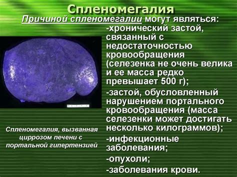 Профилактика увеличения селезенки