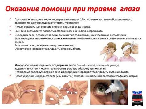 Профилактические меры для предотвращения желтизны