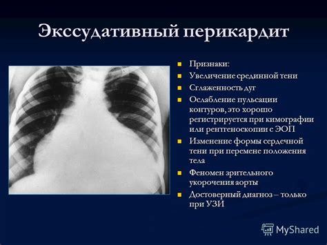 Процесс кимографии