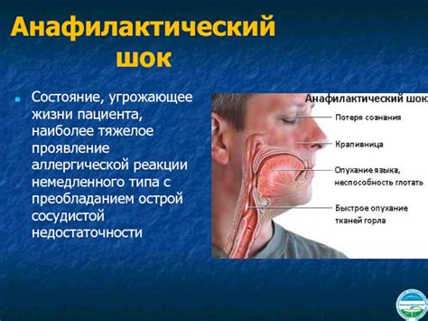 Проявление аллергической реакции