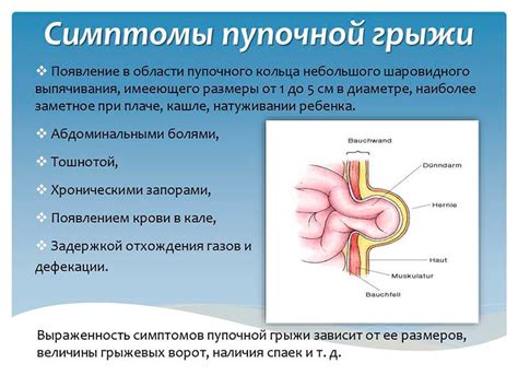 Пупочная грыжа у ребенка: причины и последствия