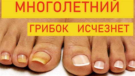 Пятишаговая процедура удаления пятен куркумы с ногтей