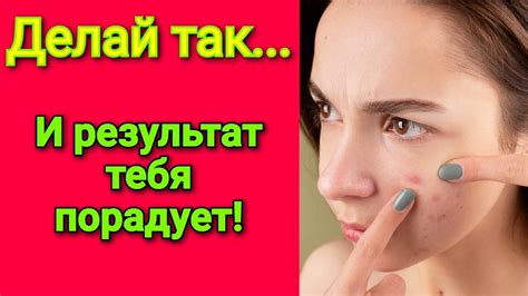 Раздел 3: Уход за проблемной кожей