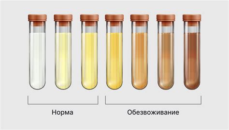 Различные причины бесцветной мочи: