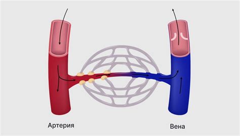 Расширение капилляров и их склонность к образованию опухолей