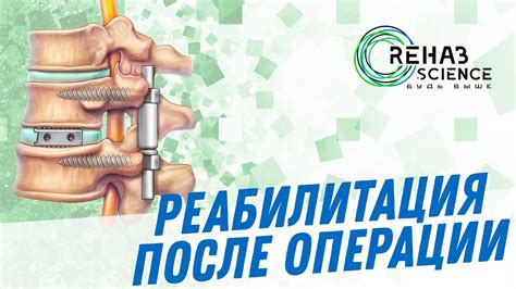 Реабилитация после операции на позвоночник