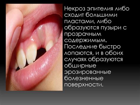 Реакция организма на стимуляцию слизистой оболочки