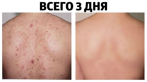 Реакция с кожей и потом