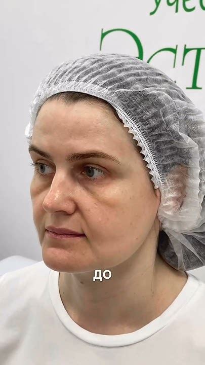 Регулярные посещения косметолога