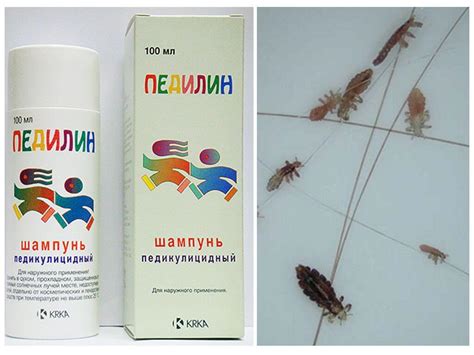 Результаты использования дихлофоса против вшей