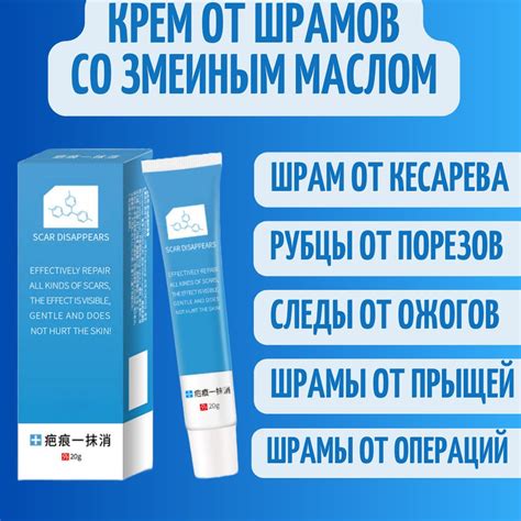 Рекомендации врачей по ходьбе по лестнице после кесарева сечения