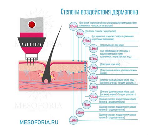 Рекомендации по выбору названия для чечевицы