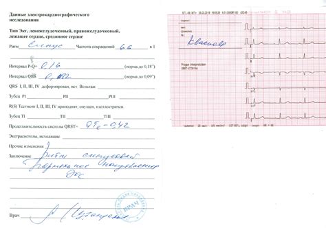 Рекомендации по приему пищи перед ЭКГ