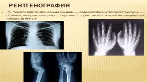 Рентгенологические методы определения ЧМТ у стрижа