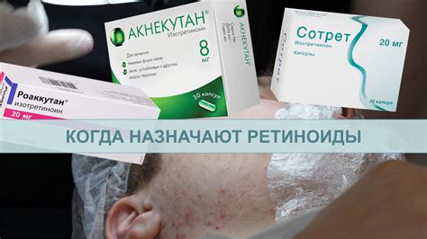Ретиноиды и фоточувствительность