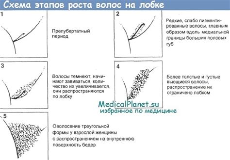 Решение проблемы внезапного роста волос на половых губах