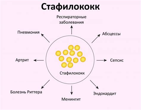 Риски передачи золотистого стафилококка
