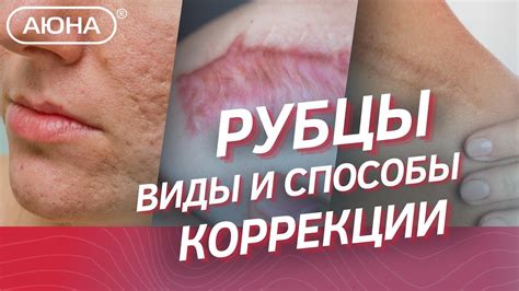 Роль питания в процессе устранения рубцов на лице