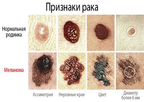 Самые распространенные повреждения искусственной кожи