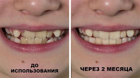 Связь закрытия рта во время зевоты с уровнем вежливости и этикета