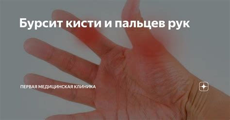 Связь с особенностями руки