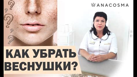 Секреты безупречной кожи: уничтожаем веснушки навсегда