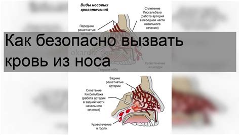 Серьезные заболевания, вызывающие кровь из носа и ушей