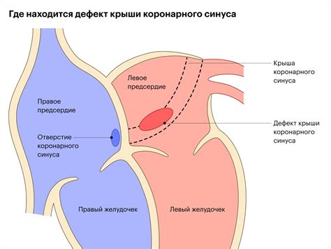 Серьезные заболевания могут приводить к повреждению кровеносных сосудов