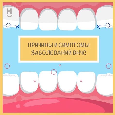 Симптомы и возможные причины дискомфорта в области челюсти