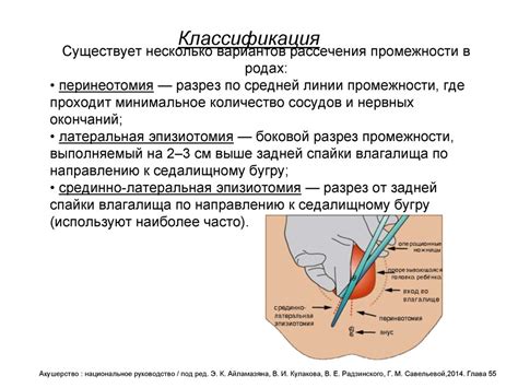 Симптомы и последствия чешущейся промежности