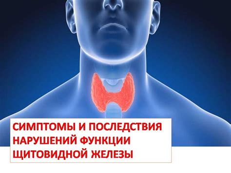 Симптомы и признаки нарушений функции щитовидной железы