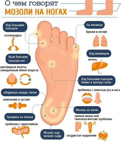 Симптомы и причины возникновения мозоли на пальце