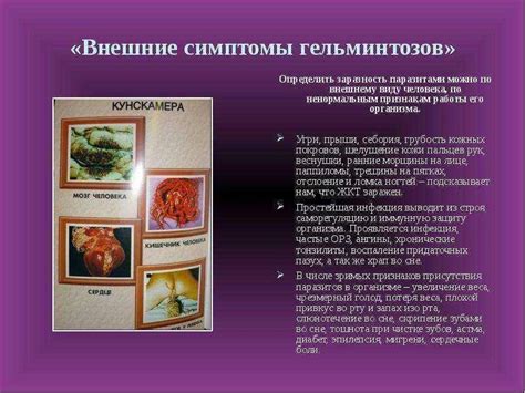 Симптомы наличия глистов у ребенка