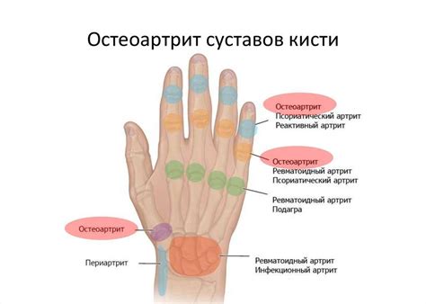 Симптомы онемения пальцев рук