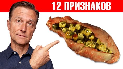 Симптомы полного загиба желчного пузыря