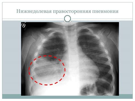 Симптомы проблем с функцией легких у ребенка 7 лет