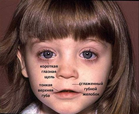 Симптомы серого цвета лица у ребенка