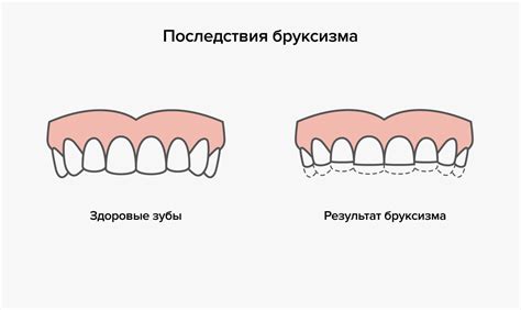 Скрытые эмоции: почему мужчины стискивают зубы