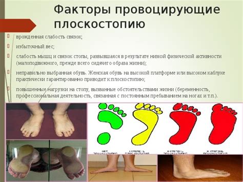 Слабость и дисбаланс мышц стопы
