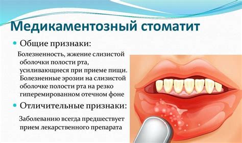 Слизистые кисты и афтозный стоматит