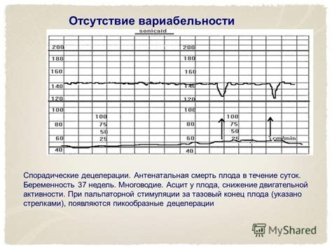 Снижение активности роста плода