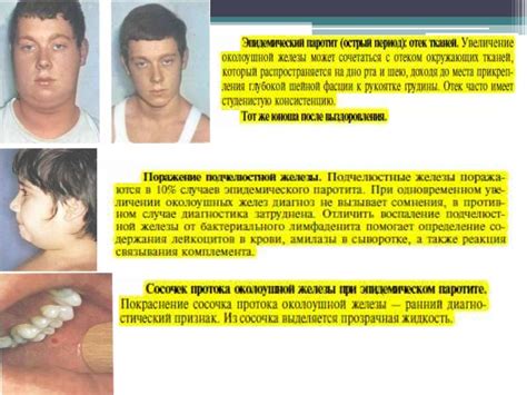 Снижение активности слюнных желез