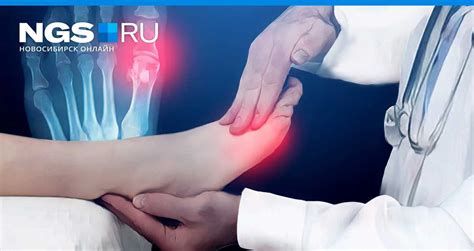 Снижение уровня мочевой кислоты: простые и эффективные методы