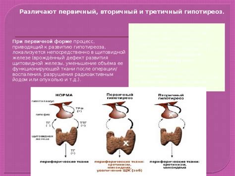 Снижение функции щитовидной железы
